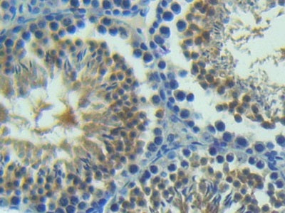 Angiopoietin 2 (ANGPT2) Polyclonal Antibody - image 4