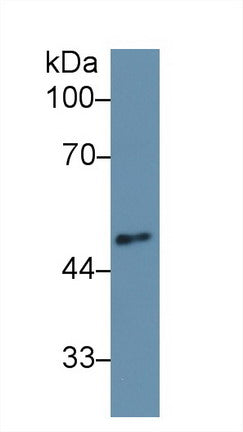 Western Blot; Sample: Recombinant protein.