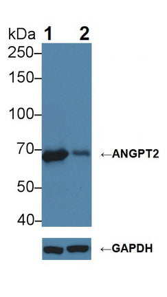 DAB staining on IHC-P; Samples: Human Placenta Tissue;  Primary Ab: 20μg/ml Rabbit Anti-Human ANGPT2 Antibody Second Ab: 2µg/mL HRP-Linked Caprine Anti-Rabbit IgG Polyclonal Antibody