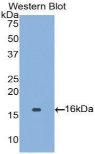 Angiopoietin 2 (ANGPT2) Polyclonal Antibody - image 2