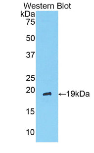 DAB staining on IHC-P; Samples: Rat Testis Tissue; Primary Ab: 10µg/ml Rabbit Anti-Rat ANGPT1 Antibody Second Ab: 2µg/mL HRP-Linked Caprine Anti-Rabbit IgG Polyclonal Antibody