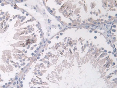 DAB staining on IHC-P; Samples: Rat Brain Tissue.