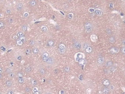 Angiopoietin 1 (ANGPT1) Polyclonal Antibody - image 5