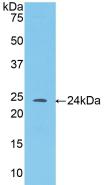 Angiopoietin 1 (ANGPT1) Polyclonal Antibody - image 2