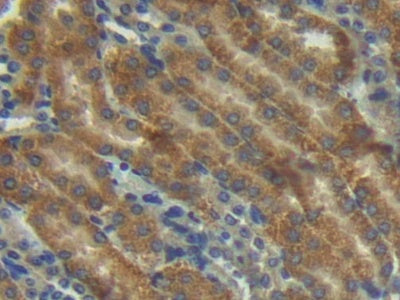 Angiopoietin 1 (ANGPT1) Polyclonal Antibody - image 3