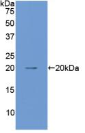 Angiopoietin 1 (ANGPT1) Polyclonal Antibody - image 2