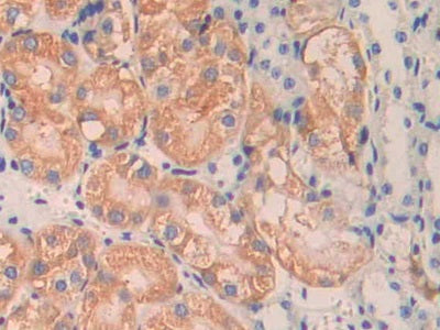 Angiopoietin 1 (ANGPT1) Polyclonal Antibody - image 4