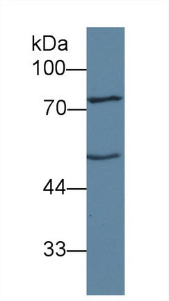 Western Blot; Sample: Recombinant protein.