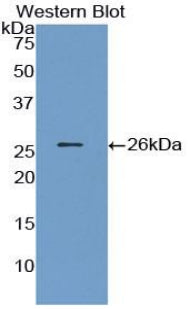 Angiopoietin 1 (ANGPT1) Polyclonal Antibody - image 3