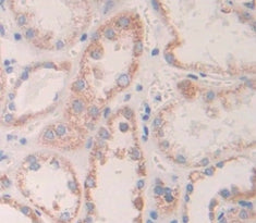 Angiopoietin 1 (ANGPT1) Polyclonal Antibody - image 4