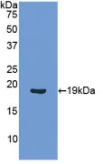 DAB staining on IHC-P; Samples: Human Kidney Tissue; Primary Ab: 20μg/ml Rabbit Anti-Human ANGPT1 Antibody Second Ab: 2µg/mL HRP-Linked Caprine Anti-Rabbit IgG Polyclonal Antibody