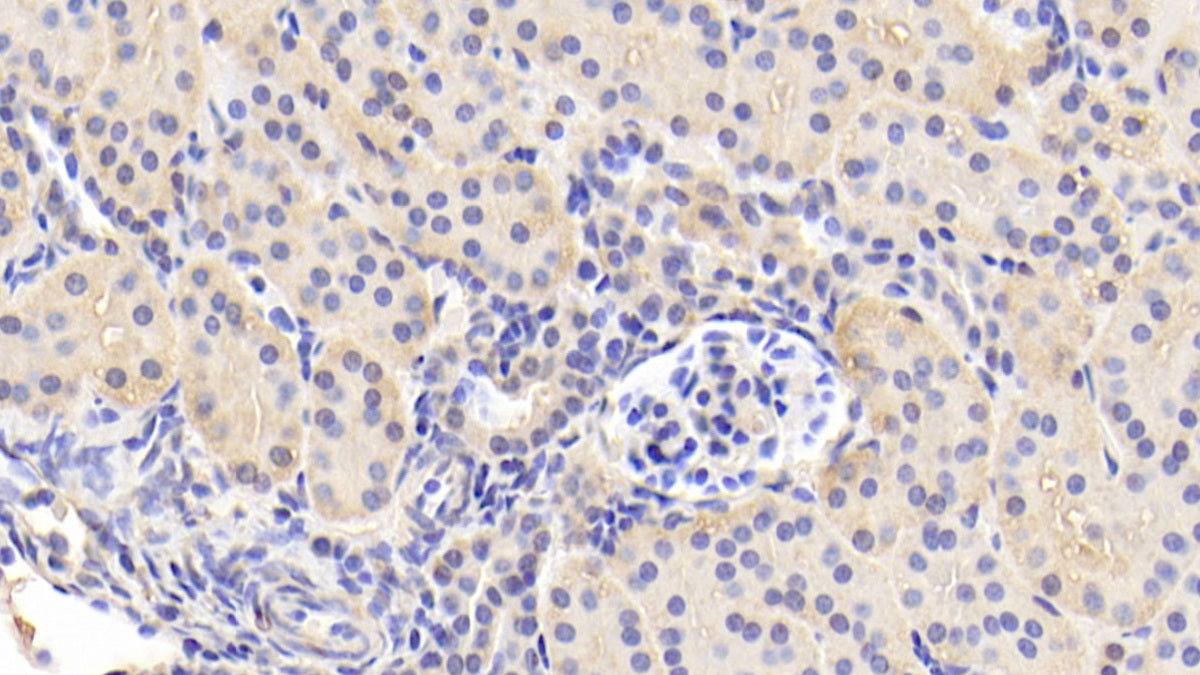 DAB staining on IHC-P. Samples: Human Tissue)