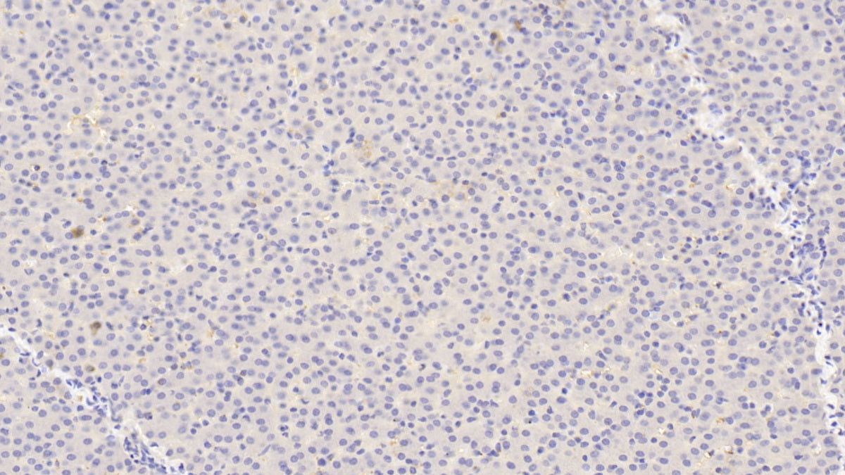 Angiopoietin 1 (ANGPT1) Polyclonal Antibody - image 5
