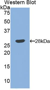 Angiopoietin 1 (ANGPT1) Polyclonal Antibody - image 2