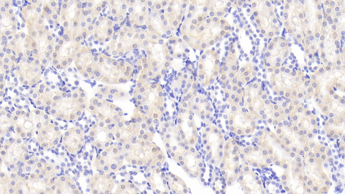 Angiogenin (ANG) Polyclonal Antibody - image 5