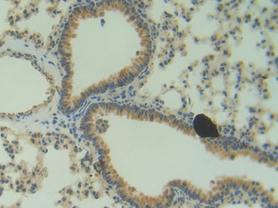 DAB staining on fromalin fixed paraffin- embedded brain tissue)