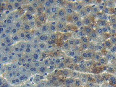 Angiogenin (ANG) Polyclonal Antibody - image 4
