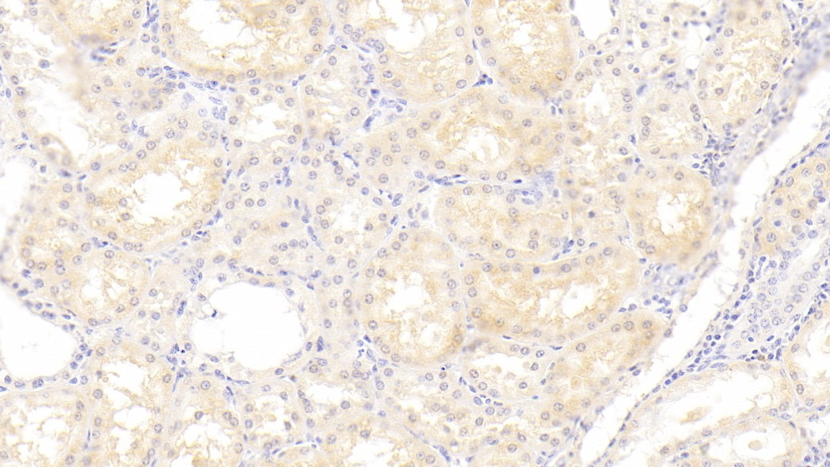 DAB staining on fromalin fixed paraffin-embedded liver tissue)