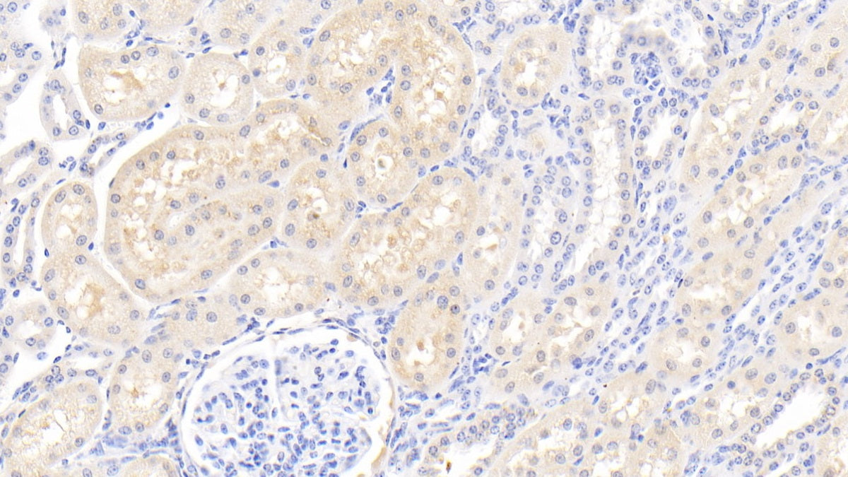 Angiogenin (ANG) Polyclonal Antibody - image 4