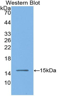 Angiotensin I Converting Enzyme (ACE) Polyclonal Antibody - image 2