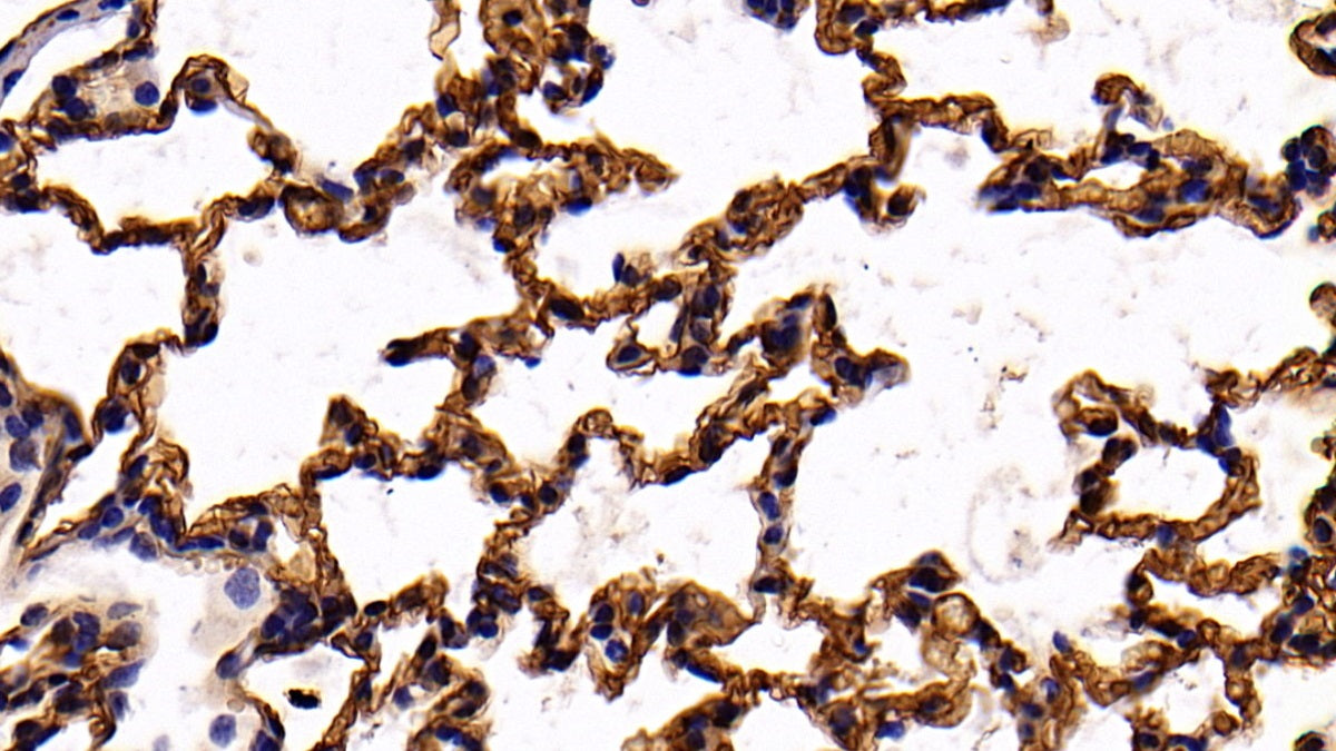 Angiotensin I Converting Enzyme (ACE) Polyclonal Antibody - image 3