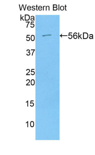 Angiotensin I Converting Enzyme (ACE) Polyclonal Antibody - image 2