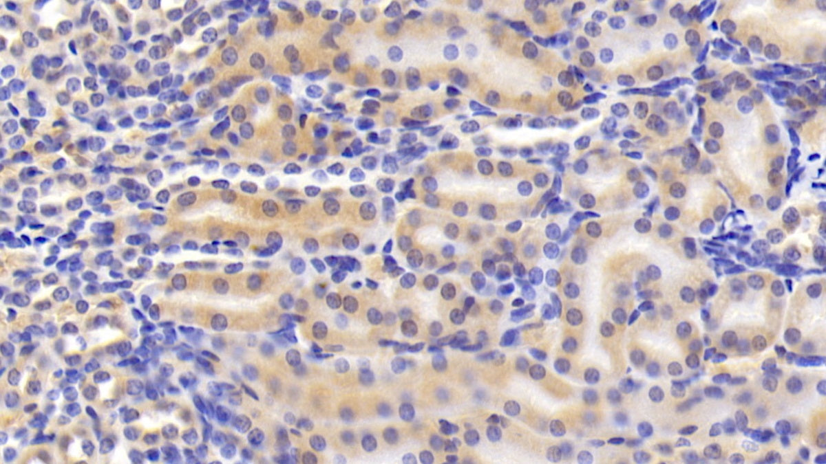 Angiotensin I Converting Enzyme (ACE) Polyclonal Antibody - image 3
