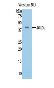 Angiotensin I Converting Enzyme (ACE) Polyclonal Antibody - image 2
