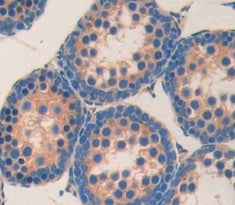 Angiotensin I Converting Enzyme (ACE) Polyclonal Antibody - image 4