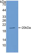 Angiotensin I Converting Enzyme (ACE) Polyclonal Antibody - image 2