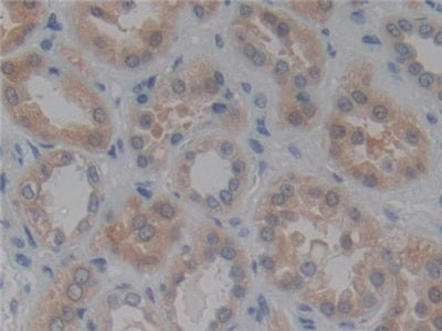 DAB staining on IHC-P; Samples: Human Liver Tissue