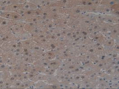 Angiotensin I Converting Enzyme (ACE) Polyclonal Antibody - image 4