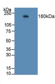Western Blot; Sample: Recombinant ACE, Human.