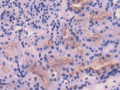 Angiotensin I Converting Enzyme (ACE) Polyclonal Antibody - image 5