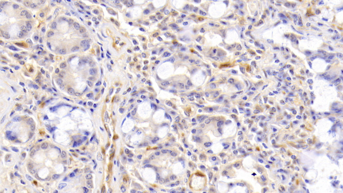 DAB staining on fromalin fixed paraffin- embedded Kidney tissue)