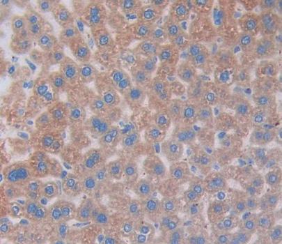 Vitronectin (VTN) Polyclonal Antibody - image 4