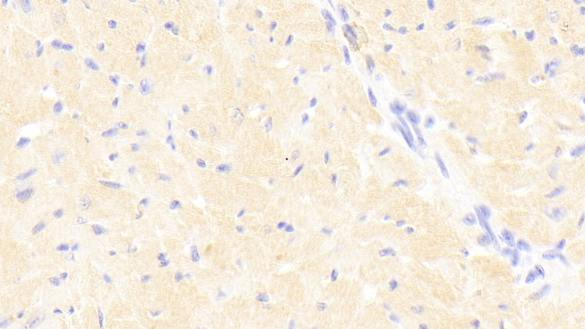 Signal Transducer And Activator Of Transcription 3 (STAT3) Polyclonal Antibody - image 5