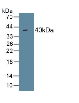 Procollagen I N-Terminal Propeptide (PINP) Polyclonal Antibody - image 2