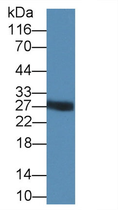 Trypsin (TRY) Polyclonal Antibody - image 2