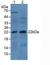Western Blot; Sample: Lane1: 293T cell lysate; Lane2: Raji cell lysate; Primary Ab: 0.2μg/ml Rabbit Anti-Human Bax Antibody; Second Ab: 0.2µg/mL HRP-Linked Caprine Anti-Rabbit IgG Polyclonal Antibody;