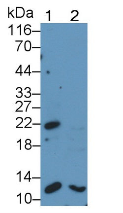 DAB staining on IHC-P; Samples: Human Kidney Tissue; Primary Ab: 10µg/ml Rabbit Anti-Human Bax Antibody Second Ab: 2µg/mL HRP-Linked Caprine Anti-Rabbit IgG Polyclonal Antibody