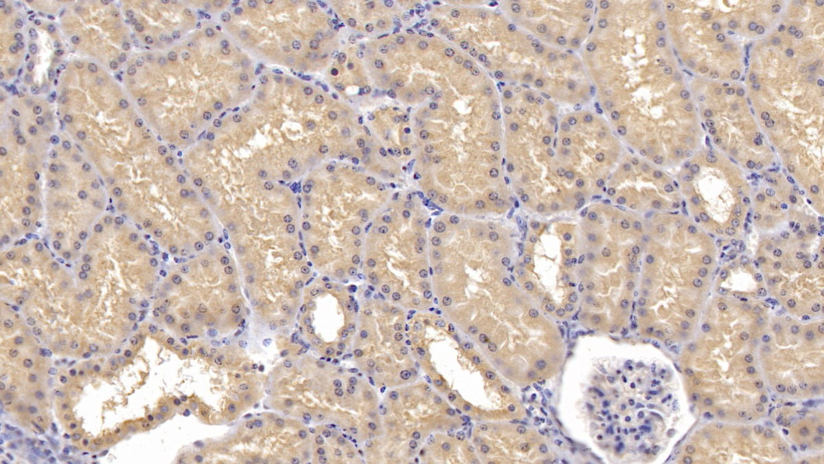 DAB staining on IHC-P; Samples: Human Adrenal gland Tissue; Primary Ab: 10ug/ml Rabbit Anti-Human Bax Antibody Second Ab: 2µg/mL HRP-Linked Caprine Anti-Rabbit IgG Polyclonal Antibody