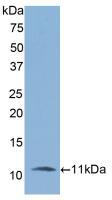 Interleukin 6 Receptor (IL6R) Polyclonal Antibody - image 3