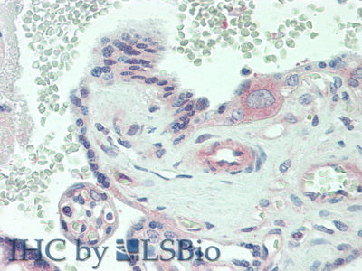 Interleukin 6 Receptor (IL6R) Polyclonal Antibody - image 5