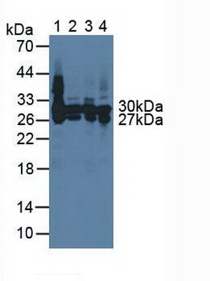 Western Blot; Sample: Recombinant CA2, Rat.
