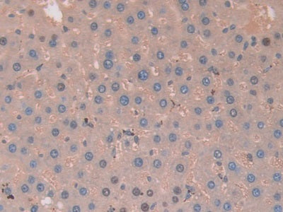 DAB staining on IHC-P; Samples: Rat Spinal Marrow Tissue.