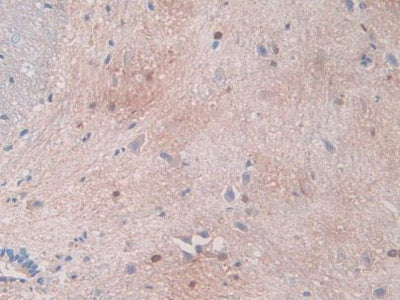 Carbonic Anhydrase II (CA2) Polyclonal Antibody - image 5