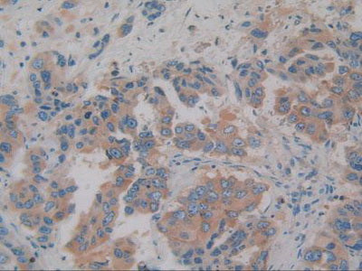 Alpha-2-Glycoprotein 1, Zinc Binding (aZGP1) Polyclonal Antibody - image 5