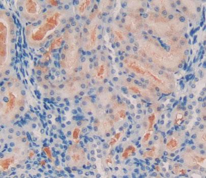 DAB staining on IHC-P; Samples：Human Spleen Tissue.