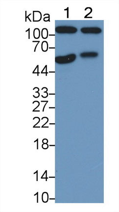 DAB staining on IHC-P; Samples: Human Lung cancer Tissue;  Primary Ab: 20µg/ml Mouse Anti-Human AREG
